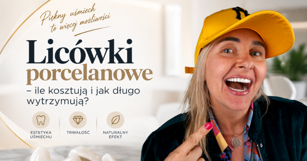 Licówki porcelanowe – ile kosztują i jak długo wytrzymują